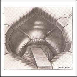 DARK UNION - 'Hollywound' LP